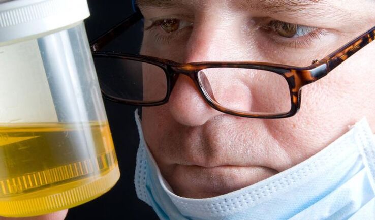 vizeletvizsgálat krónikus prosztatagyulladásra